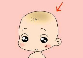 舅舅屎是什么 寶寶頭上的舅舅屎怎么去除