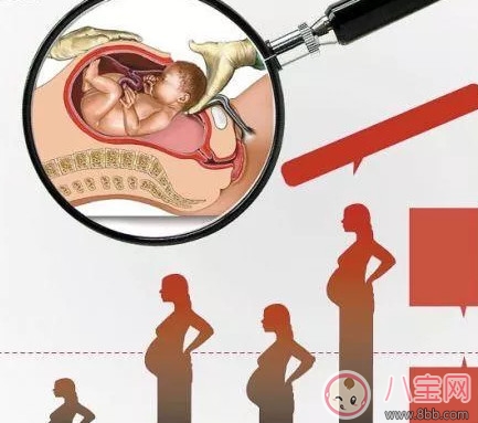 剖腹產孕婦會不會感到疼痛 剖腹產橫剖還是縱剖。