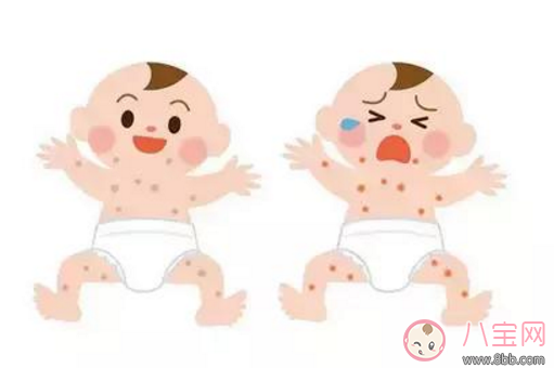 寶寶長痱子怎么辦 給寶寶去痱子的方法有哪些