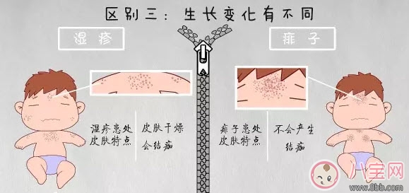 寶寶痱子和濕疹的區別 濕疹和痱子的區別圖片