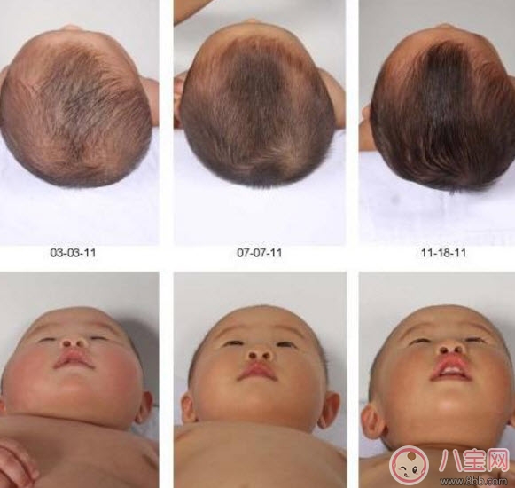 寶寶頭型睡偏了怎么辦 寶寶頭型調整怎么做