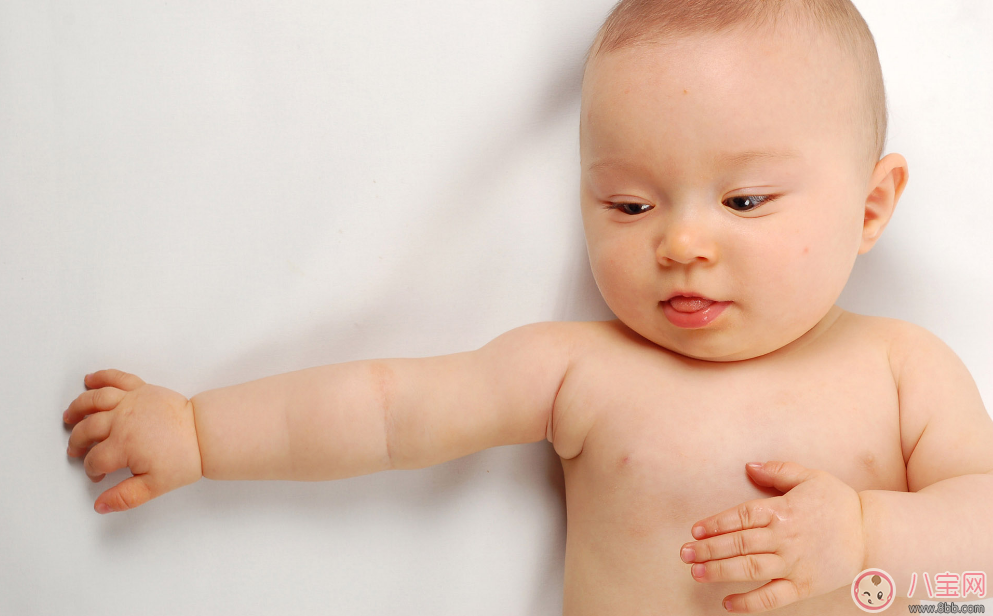 糖寶寶在嬰兒時期有哪些癥狀 怎么預防唐氏綜合癥