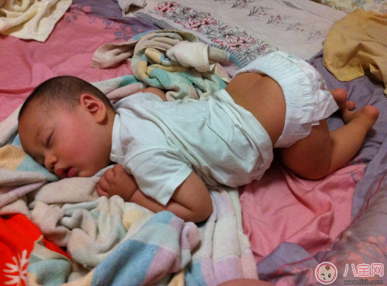 寶寶痱子總不消 用用這個準會好 寶寶痱子總不消 用用這個準會好