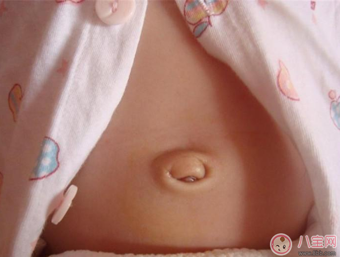 寶寶肚臍護理有方法 三不要方法要記牢