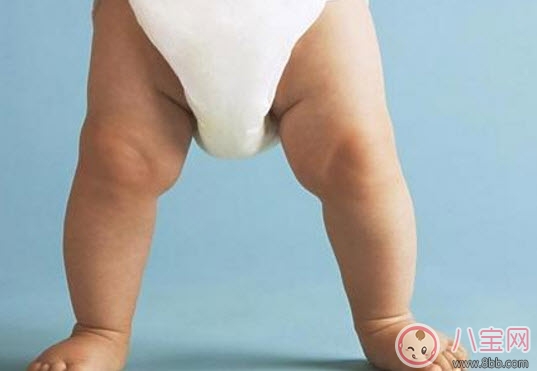 怎樣讓寶寶有大長腿 寶寶腿型注意事項