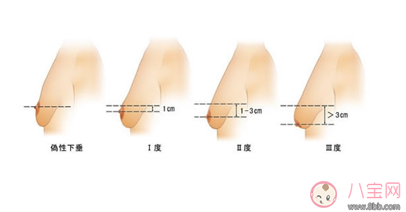 媽媽斷奶后如何豐胸 胸部下垂拯救辦法 媽媽斷奶后如何豐胸 胸部下垂拯救辦法
