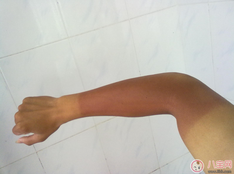 甜馨又曬黑了 如何拯救易曬黑體質