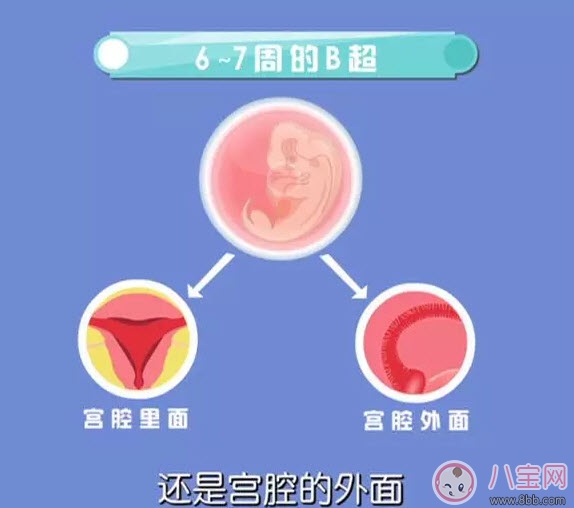 從懷孕到生要做幾次b超 懷孕做多少次b超合適(孕期b超時間表)