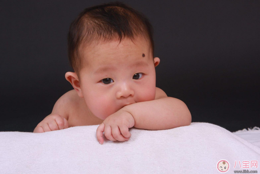 寶寶胎記會自己掉嗎 寶寶胎記去除方法 寶寶胎記會自己掉嗎 寶寶胎記去除方法