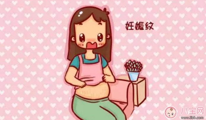 孕晚期妊娠紋怎么控制 孕晚期妊娠紋怎么緩解