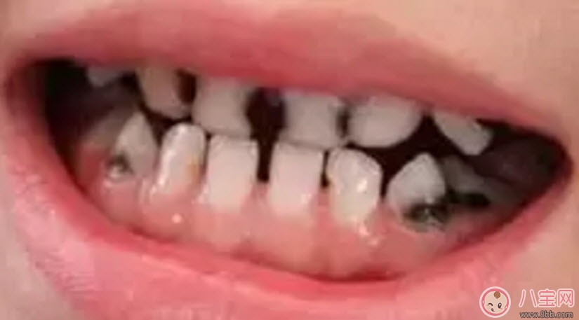 寶寶一直不愛刷牙 找對方法很關鍵 寶寶一直不愛刷牙 找對方法很關鍵