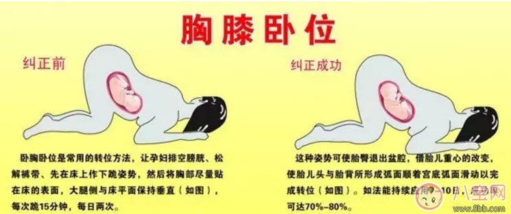 孕晚期胎位不正怎么辦 孕晚期胎位圖