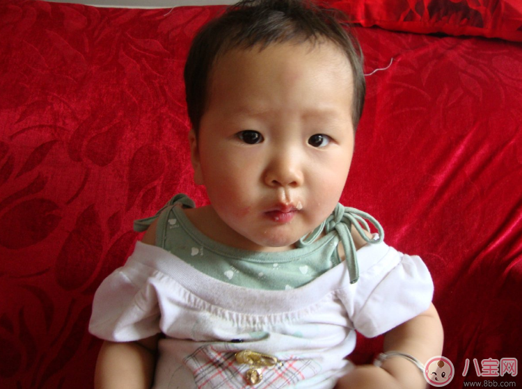 夏天孩子厭食如何開胃 清新開胃食物推薦