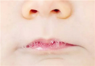 寶寶吐泡泡就是肺炎嗎 寶寶吐泡泡是怎么回事