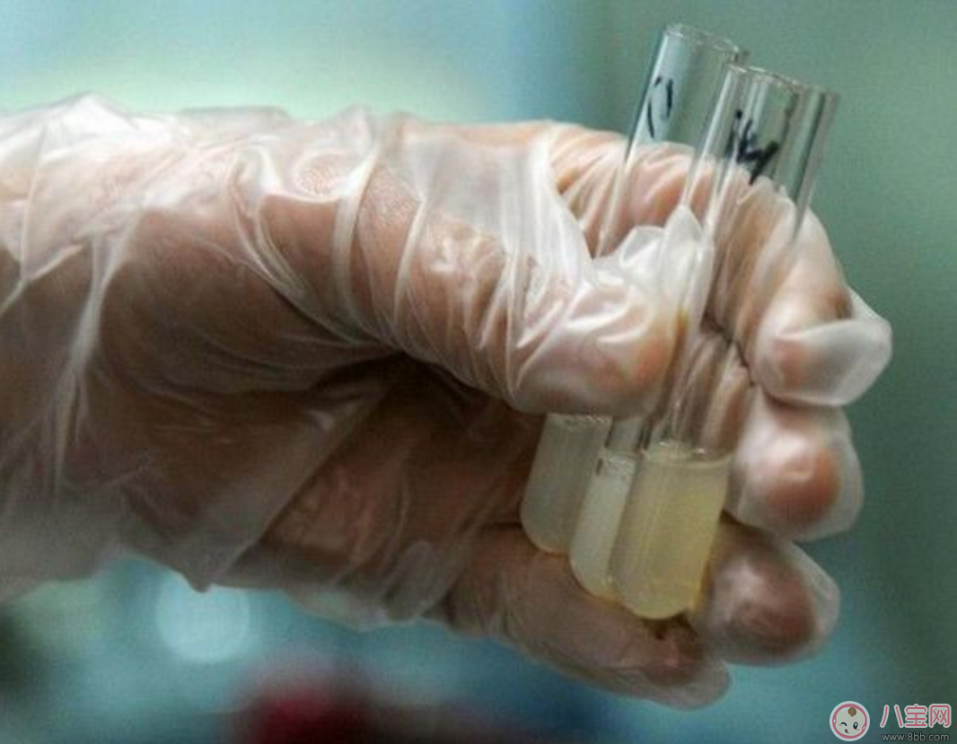 增強男性生育力 提高精子質量