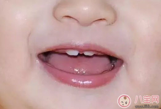 寶寶牙縫寬是什么原因 寶寶牙縫寬會自己閉攏嗎