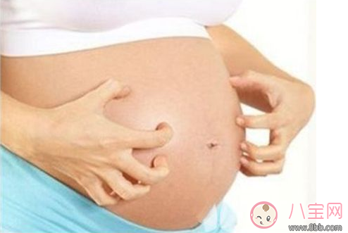 懷孕皮膚瘙癢怎么辦 快速止癢小妙招