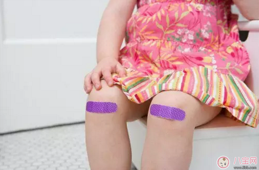 寶寶意外受傷怎么辦 如何避免破傷風