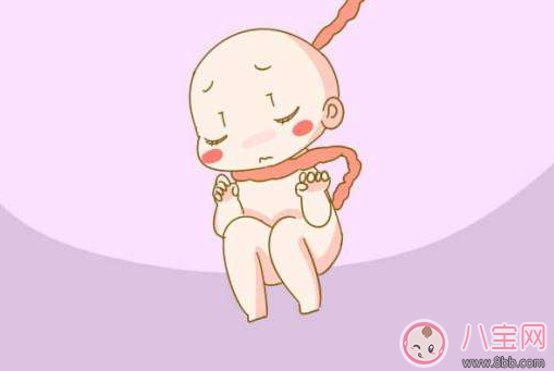 擔心胎兒臍帶繞頸怎么辦 預防臍帶繞頸方法推薦