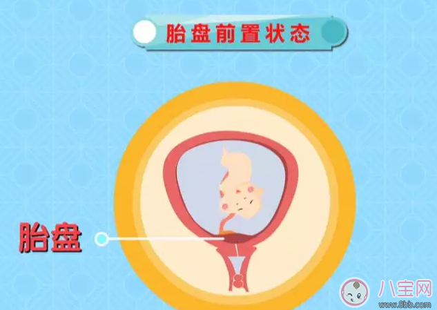 懷孕后那些情況不能順產(chǎn) 有些時(shí)候多聽(tīng)醫(yī)囑準(zhǔn)沒(méi)錯(cuò)