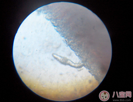 喝生水長寄生蟲是真的嗎 喝生水會有寄生蟲嗎 喝生水長寄生蟲是真的嗎 喝生水會有寄生蟲嗎