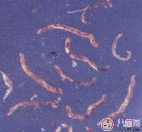 喝生水長寄生蟲是真的嗎 喝生水會有寄生蟲嗎 喝生水長寄生蟲是真的嗎 喝生水會有寄生蟲嗎