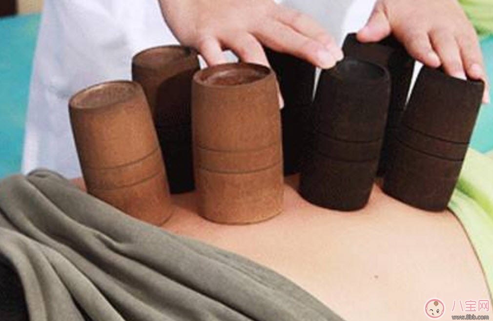 孕婦拔火罐可以嗎 孕婦肩膀能拔火罐嗎(孕婦拔過火罐怎么辦) 孕婦拔火罐可以嗎 孕婦肩膀能拔火罐嗎(孕婦拔過火罐怎么辦)