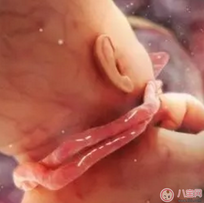 胎兒臍帶繞頸怎么辦?產前怎樣化解臍帶繞頸? 胎兒臍帶繞頸怎么辦?產前怎樣化解臍帶繞頸?