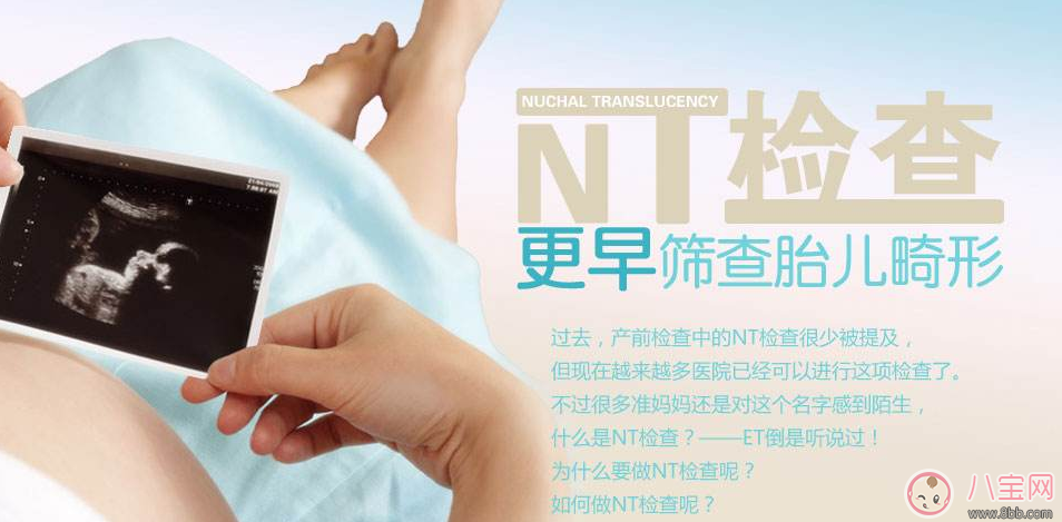 懷孕了有必要做NT檢查嗎 做NT檢查是什么體驗