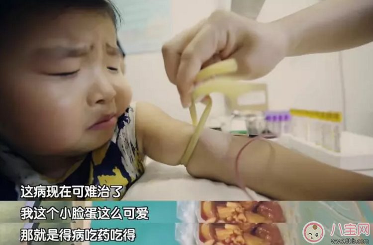 李欣蕊得了什么病 了不起的孩子萌娃李欣蕊腎病綜合征能治好嗎