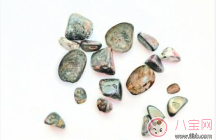 花甲結石是什么 花甲結石和普通結石有什么區別