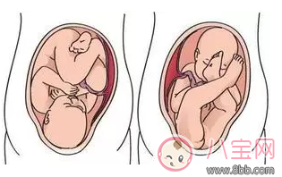 怎么在孩子沒(méi)學(xué)會(huì)走路之前發(fā)現(xiàn)髖關(guān)節(jié)發(fā)育不良 孩子髖關(guān)節(jié)發(fā)育不良怎么辦 怎么在孩子沒(méi)學(xué)會(huì)走路之前發(fā)現(xiàn)髖關(guān)節(jié)發(fā)育不良 孩子髖關(guān)節(jié)發(fā)育不良怎么辦