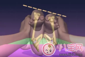 怎么在孩子沒(méi)學(xué)會(huì)走路之前發(fā)現(xiàn)髖關(guān)節(jié)發(fā)育不良 孩子髖關(guān)節(jié)發(fā)育不良怎么辦 怎么在孩子沒(méi)學(xué)會(huì)走路之前發(fā)現(xiàn)髖關(guān)節(jié)發(fā)育不良 孩子髖關(guān)節(jié)發(fā)育不良怎么辦