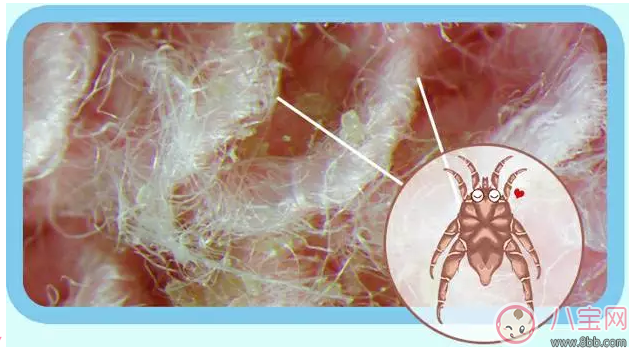 丸榮螨蟲貼有用嗎 丸榮螨蟲貼寶寶用效果好不好
