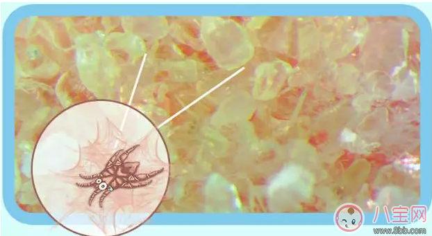 丸榮螨蟲貼有用嗎 丸榮螨蟲貼寶寶用效果好不好