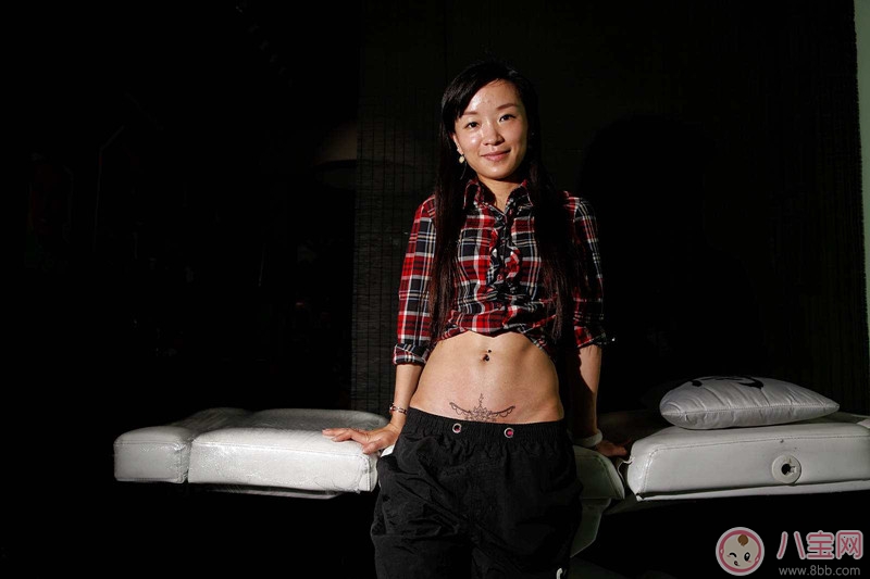 如何修復剖腹產后的疤痕 消除剖腹產疤痕有哪些方法