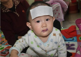 怎么區別鵝口瘡與奶塊 正確治療鵝口瘡的辦法