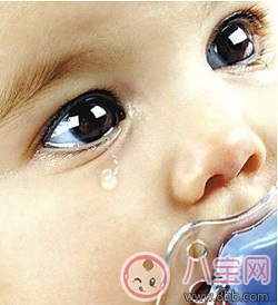 苯丙酮尿癥（PKU）是什么遺傳病 苯丙酮尿癥的臨床表現(xiàn)是什么能治療嗎