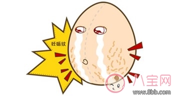 妊娠線是什么妊娠線怎么預防消除 長了妊娠線一定會有妊娠紋嗎