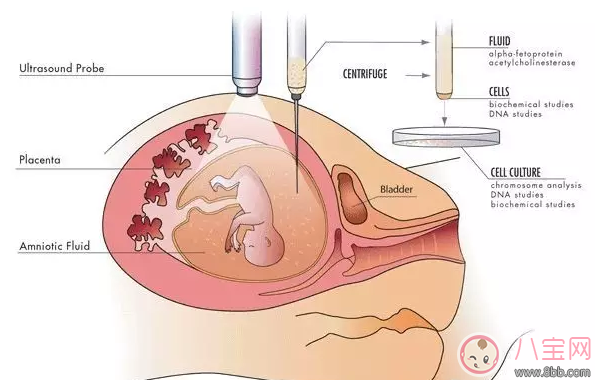 染色體異常能要孩子嗎 染色體異常怎么治