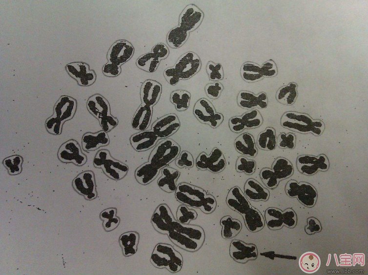 染色體異常能要孩子嗎 染色體異常怎么治