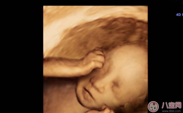 寶寶在媽媽肚子里就會哭了嗎 胎兒在肚子里哭是怎么回事