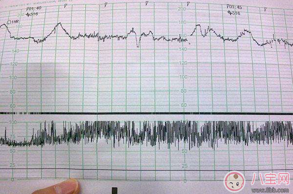 懷孕12周胎心率170有危險嗎 準媽媽怎么控制胎心率