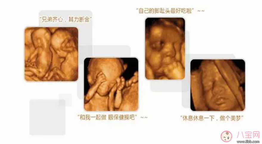 四維彩超檢查什么 孕期什么時候做效果最好