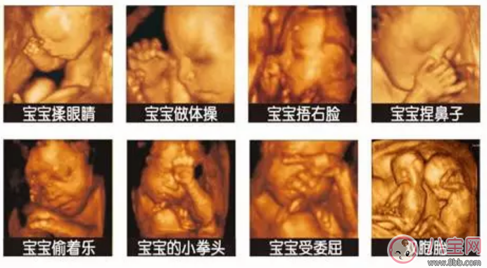 四維彩超多少錢 四維彩超檢查報告怎么看