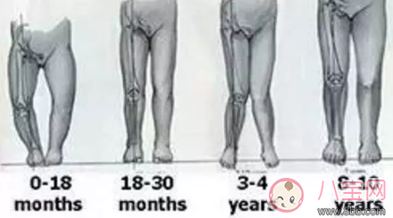 寶寶O型腿是因為缺鈣嗎 寶寶腿型是O的要不要補鈣 寶寶O型腿是因為缺鈣嗎 寶寶腿型是O的要不要補鈣