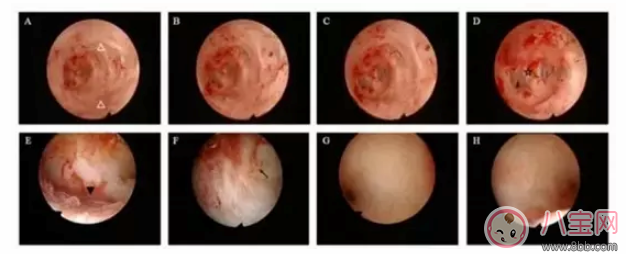 3D打印子宮是什么 3D打印子宮不用懷孕就能生孩子嗎