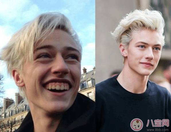 關于洗牙的注意事項 這些洗牙的誤區你聽過多少