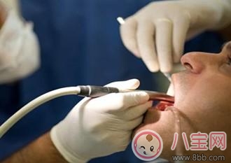 關于洗牙的注意事項 這些洗牙的誤區你聽過多少