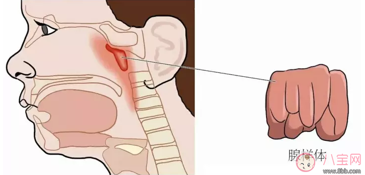 孩子喜歡打鼾是不是因為扁桃體發炎 孩子扁桃體發炎怎么辦